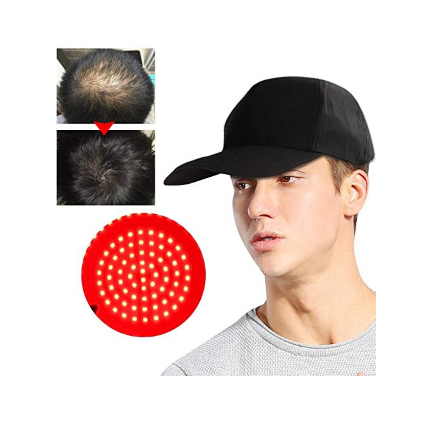 DermaCare - Red Light Kasket